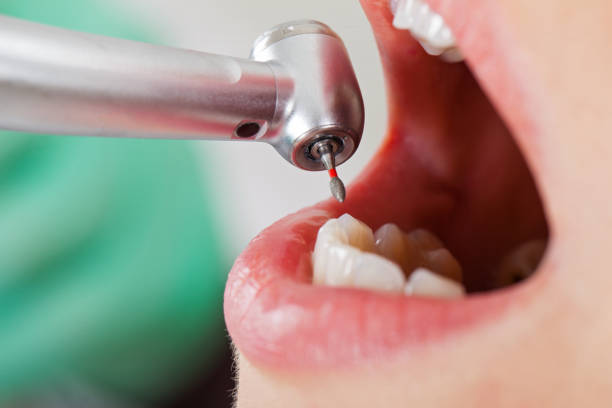 Best Knocked-Out Tooth Emergency  in Reform, AL